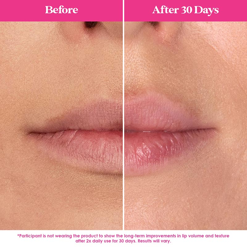 GrandeLIPS Hydrating Lip Plumper, 2.4ml - Image 11